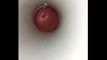 blood from man penis